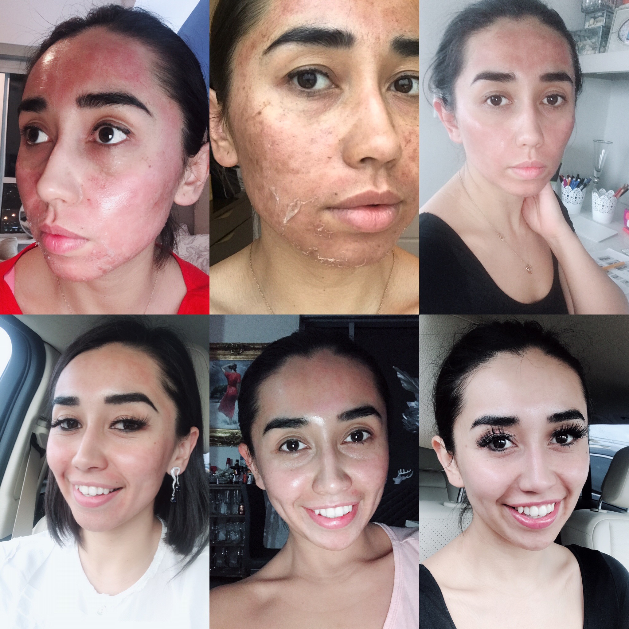 Before & After - Laser Hair Removal & MedSpa in Houston